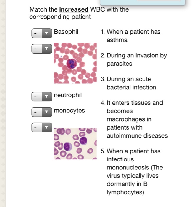 Solved Match the increased WBC with the corresponding | Chegg.com