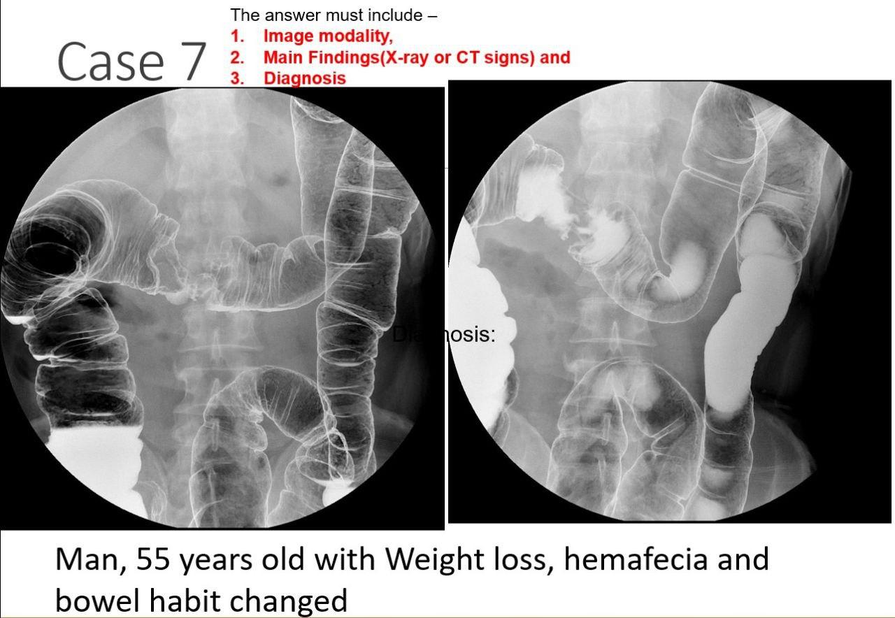 solved-this-is-medical-imaging-radiology-subject-from-mbbs-chegg