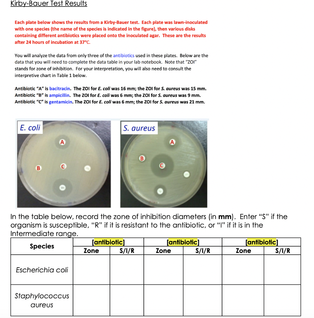 Solved KirbyBauer Test Results Each plate below shows the