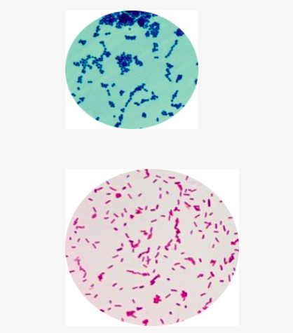 Solved Find the name of the two bacterias using the flow | Chegg.com