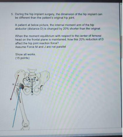 5. During the hip implant surgery, the dimension of the hip implant can be different than the patients original hip joint A