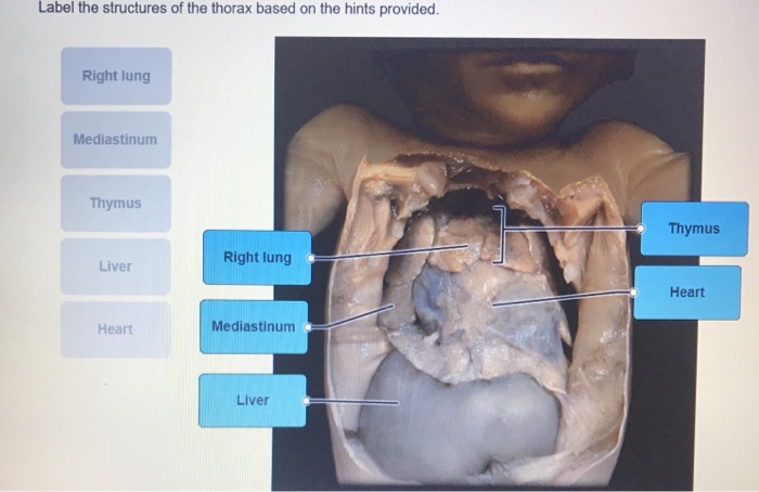30 Label The Structures Of The Bone Using The Hints Provided. - Labels