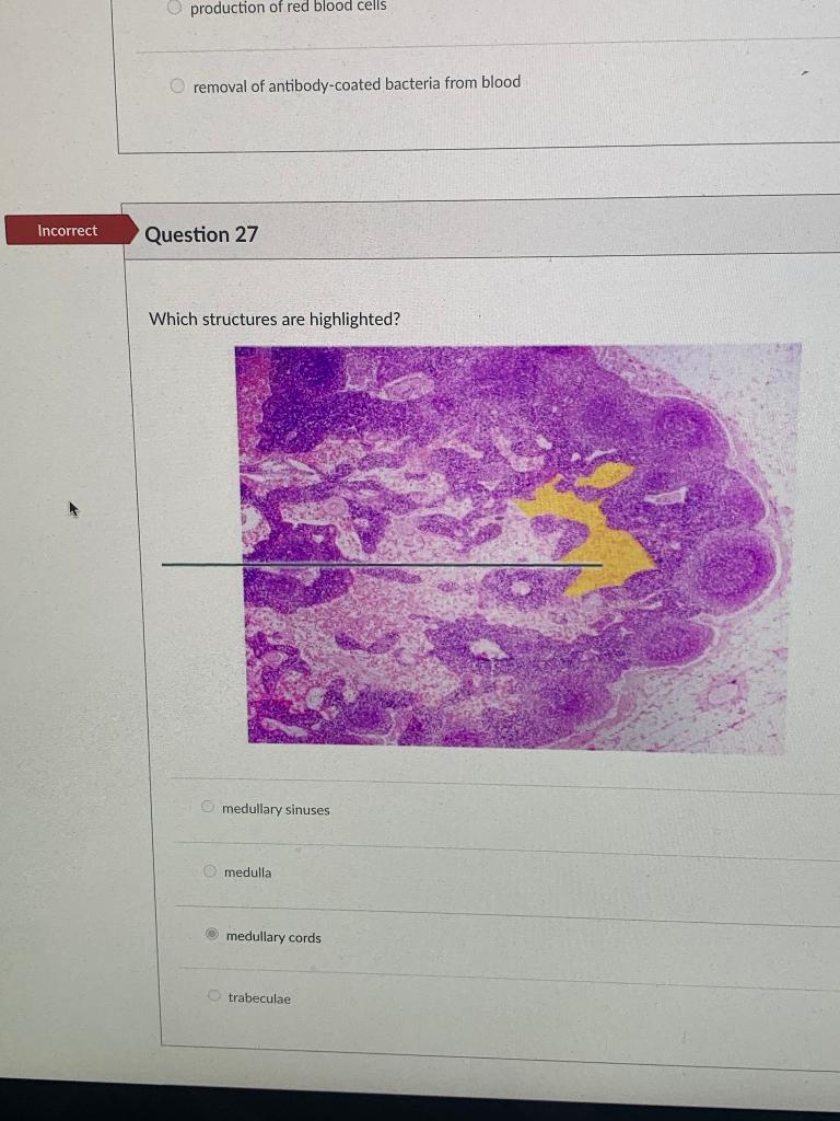 solved-production-of-red-blood-cells-removal-of-chegg