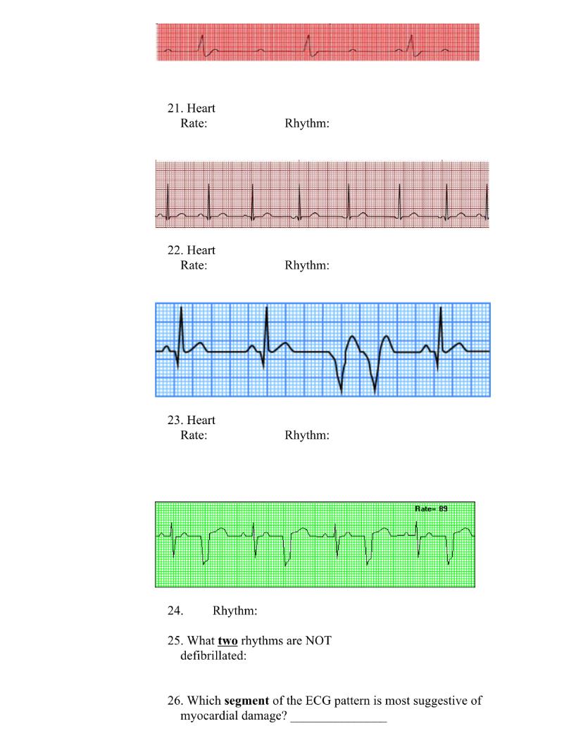 21. Heart Rate: Rhythm: 22. Heart Rate: Rhythm: 23. Heart Rate: Rhythm: Rates 89 hrepper 24. Rhythm: 25. What two rhythms are