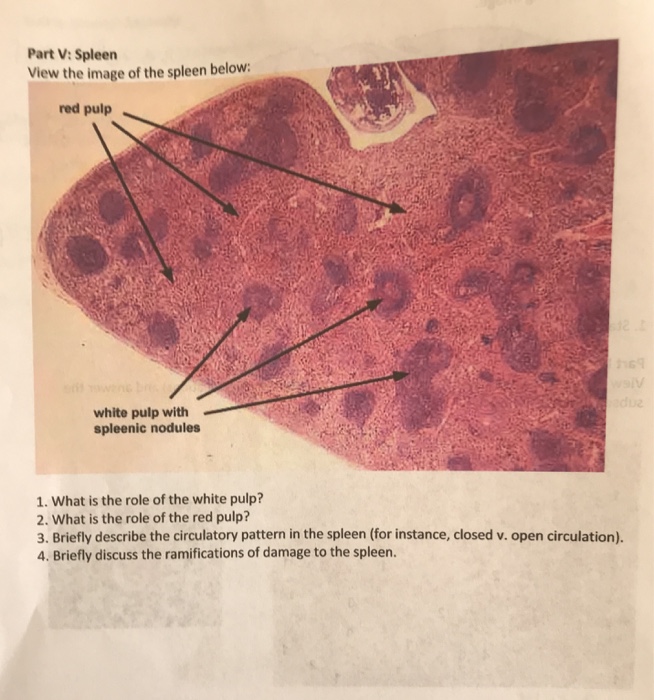 Solved Part V Spleen View the image of the spleen below red