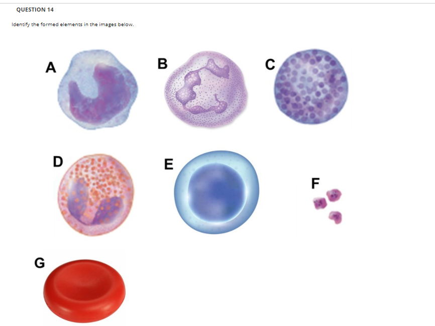 Solved QUESTION 14 Identify the formed elements in the | Chegg.com