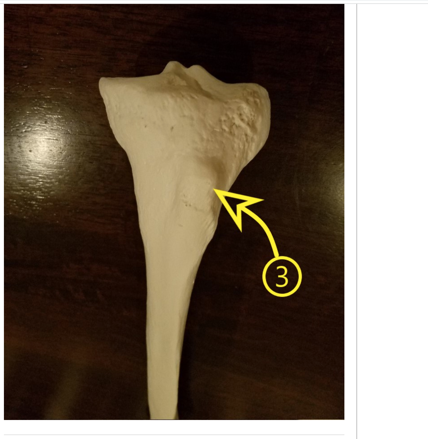 Solved List the name of the bone | Chegg.com