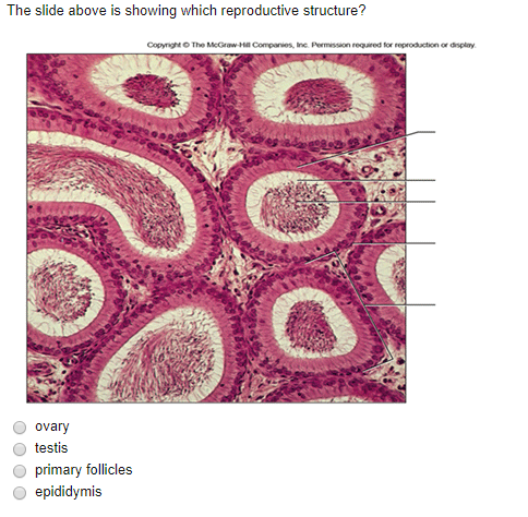 Solved The slide above is showing which reproductive | Chegg.com