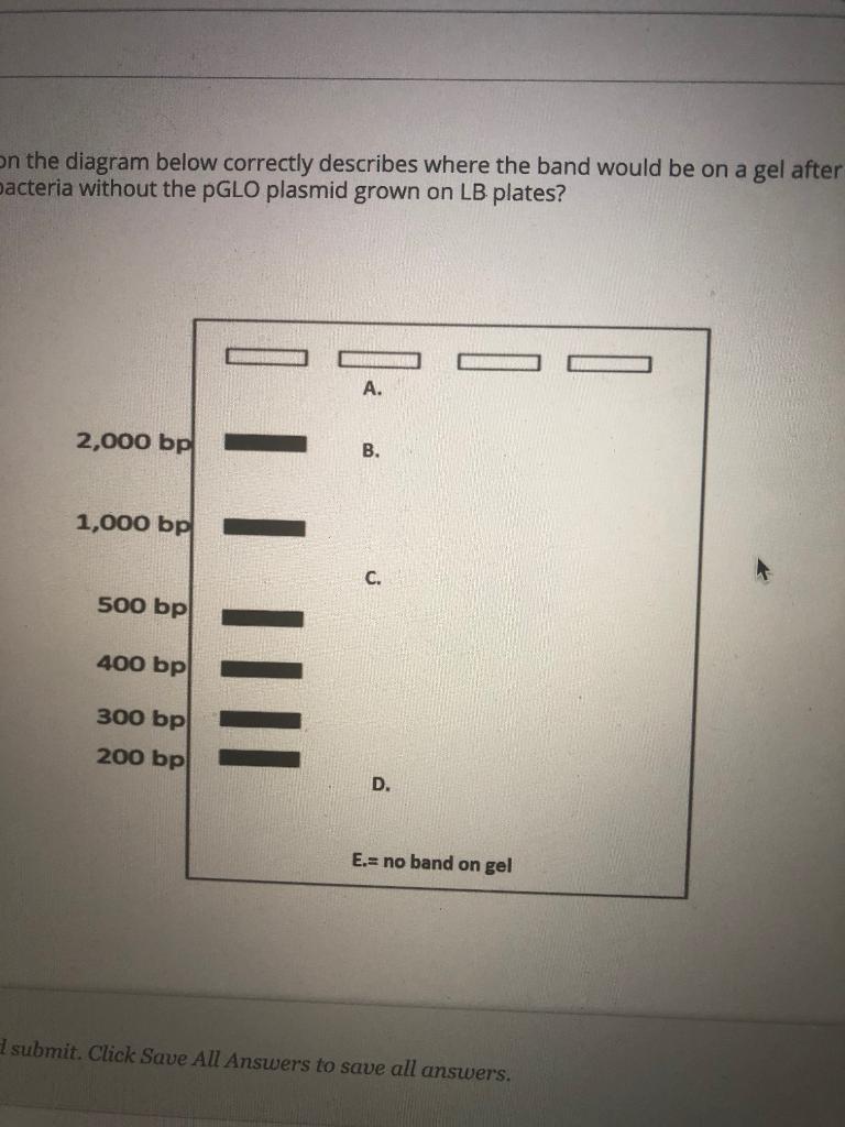 Solved Which of the following letters on the diagram below | Chegg.com