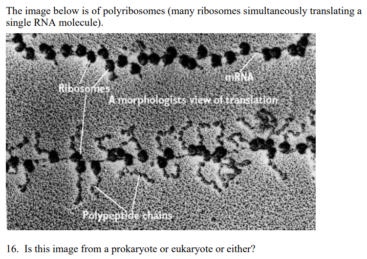 Solved The image below is of polyribosomes (many ribosomes