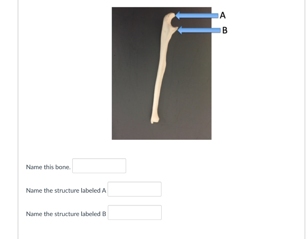 solved-name-the-structure-labeled-a-name-the-structure-chegg