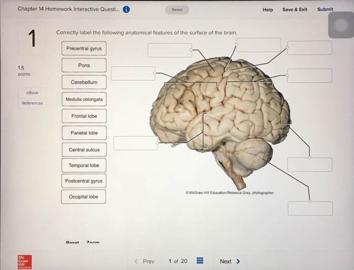 Label The Brain Anatomy Diagram Answers - Atkinsjewelry