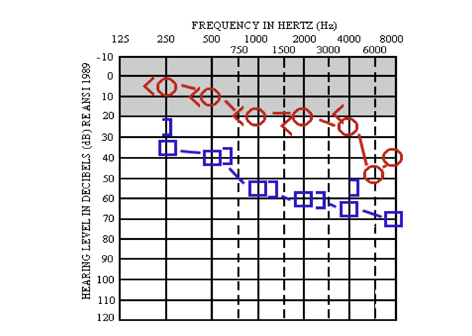 Solved Calculate the SRTs and presentation levels (MCL) for | Chegg.com