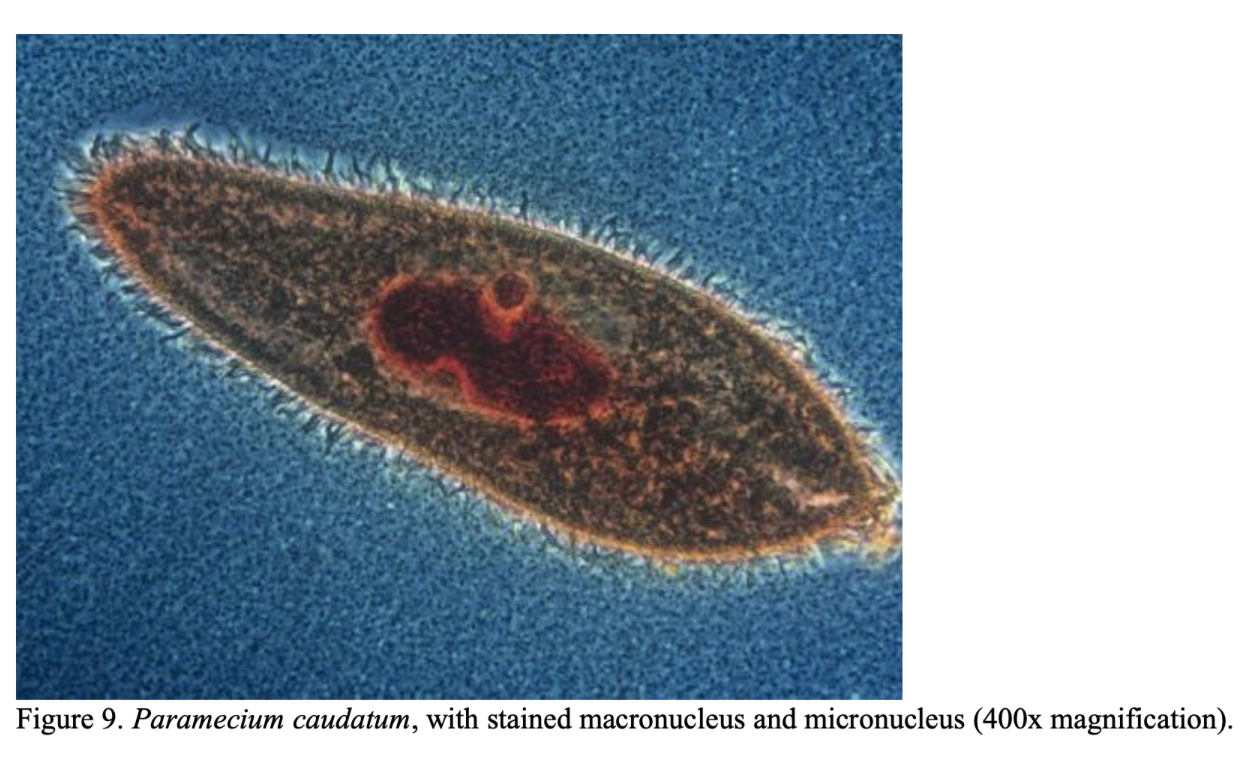 paramecium under microscope 400x