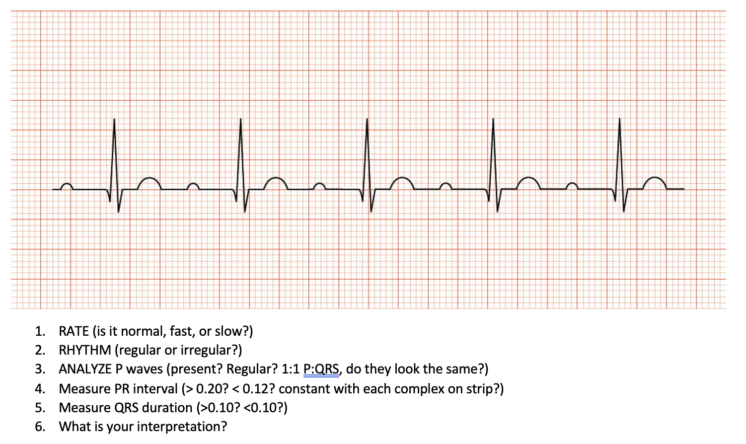 Solved 1. RATE (is it normal, fast, or slow?) 2. RHYTHM | Chegg.com