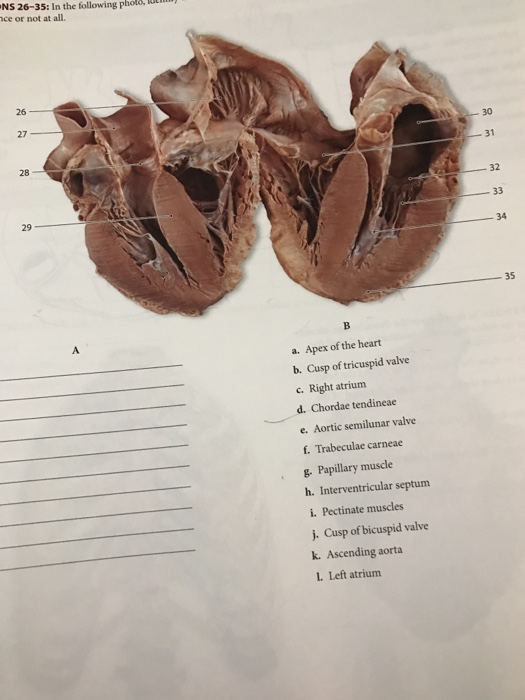 Solved Apex of the heart Cusp of tricuspid valve Right