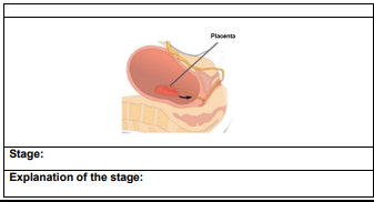 Stage:
Explanation of the stage: