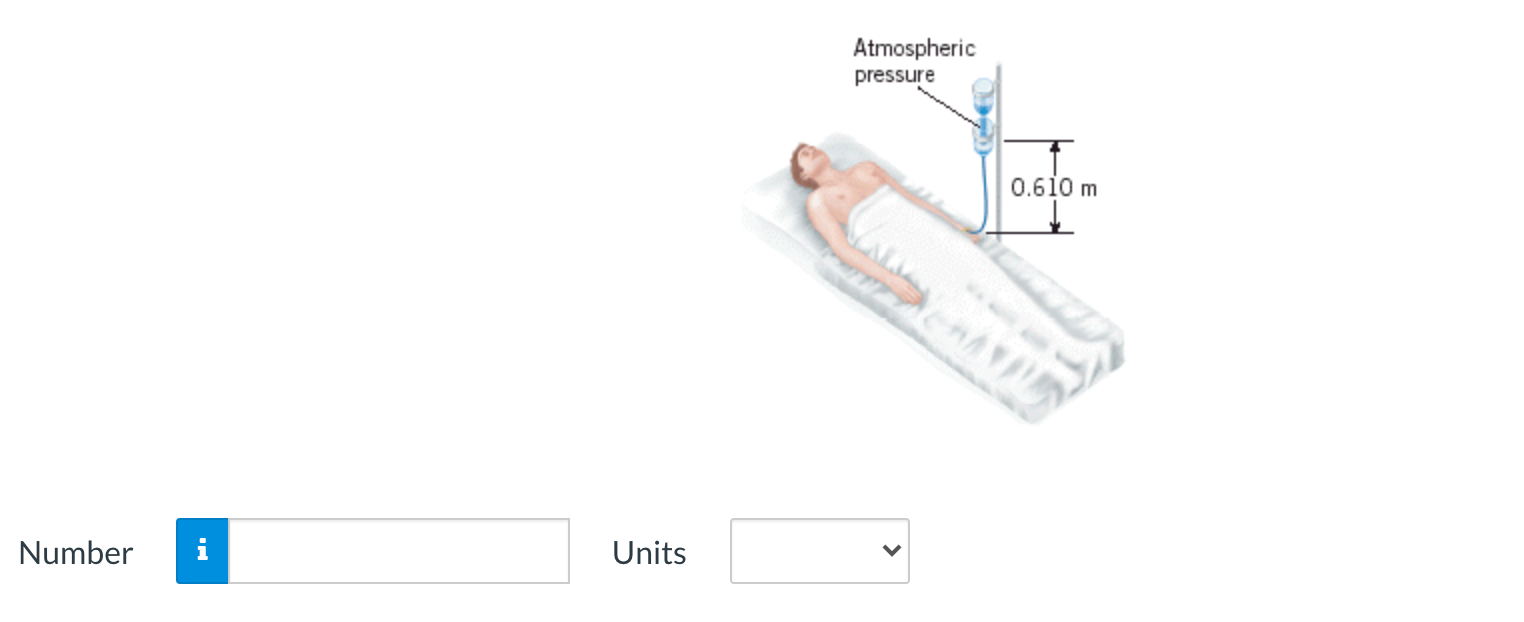 Solved The drawing shows an intravenous feeding. With the