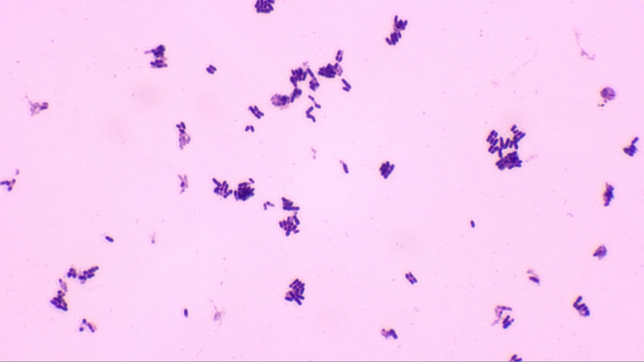 Solved Based On This Gram Stain Which Species Could This 
