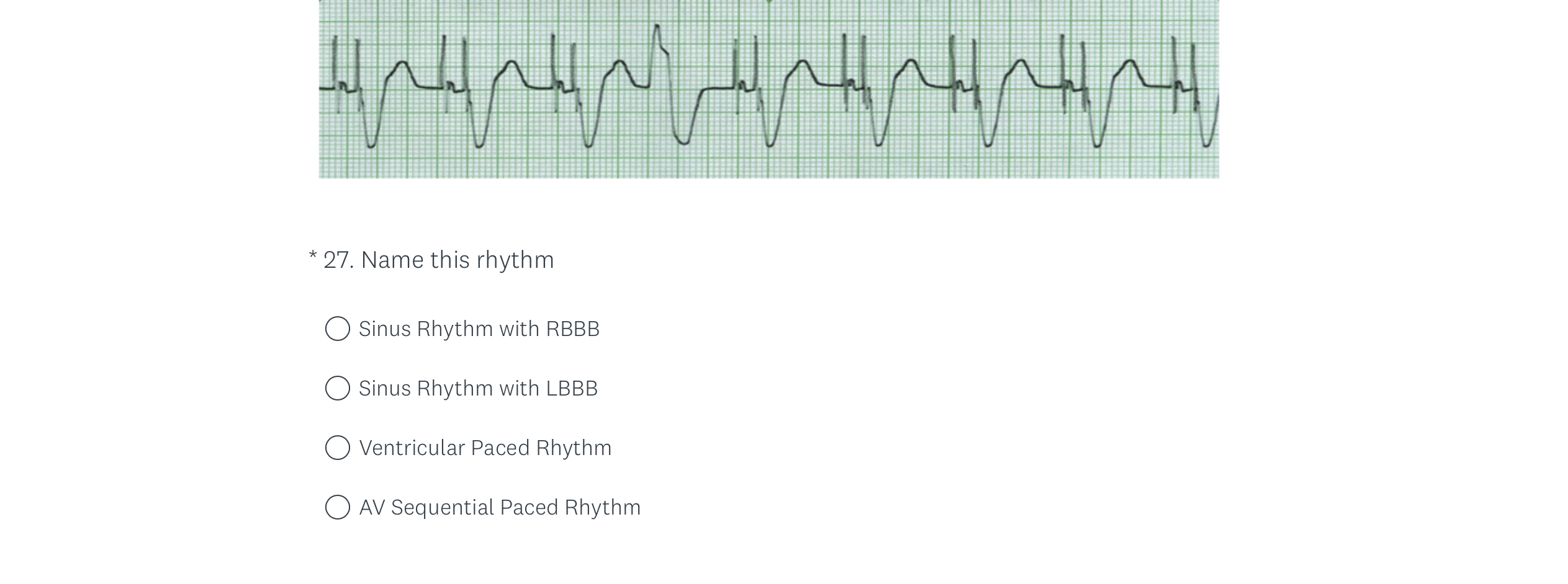 Solved Atrial fibrillation Sinus Rhythm with PJC Sinus | Chegg.com