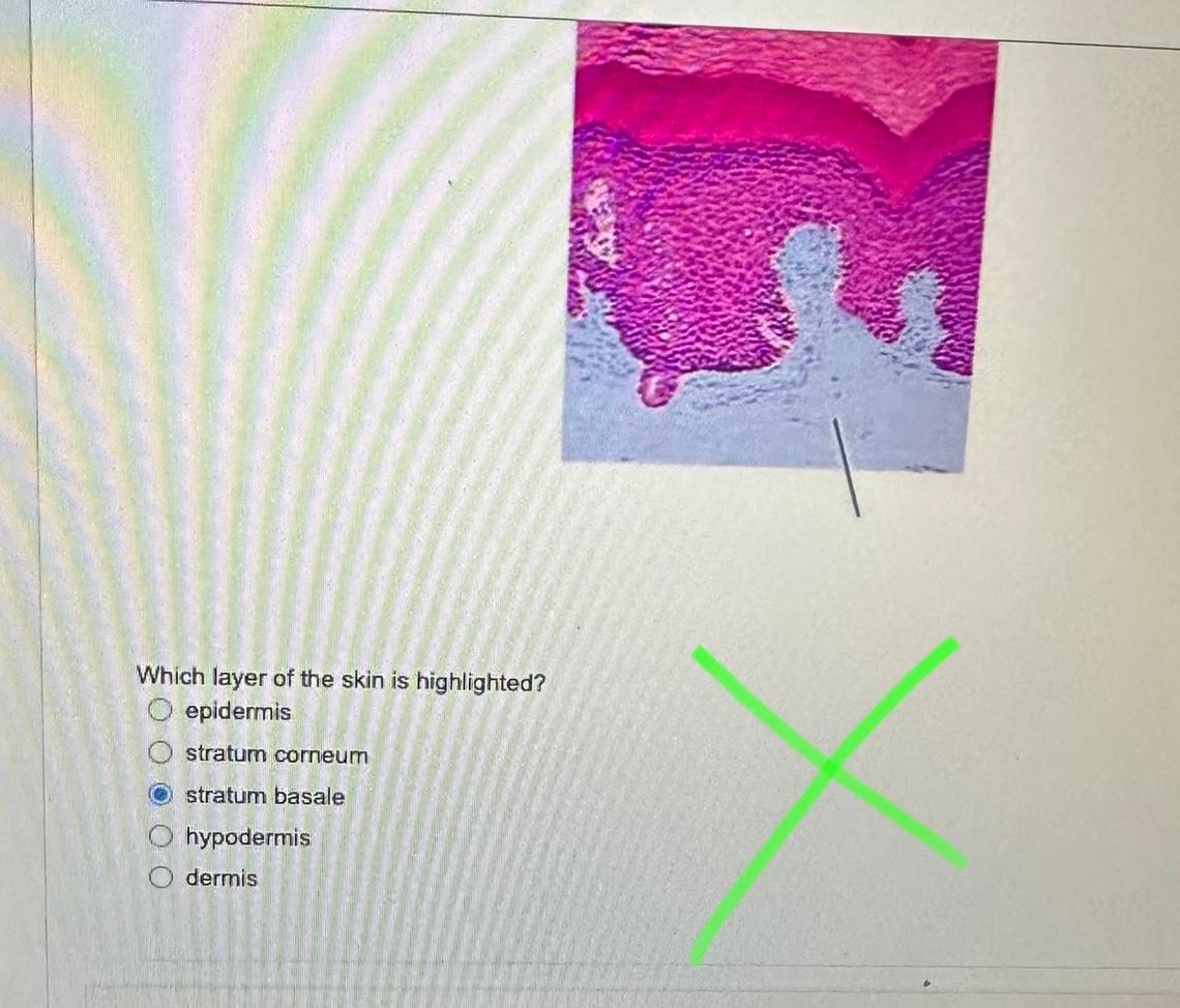 Which layer of the skin is highlighted? epidermis stratum corneum stratum basale hypodermis dermis