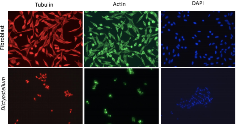 Solved 1. Describe the staining pattern obtained for | Chegg.com