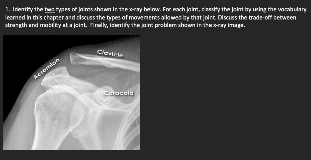 Solved 2. Identify the major joint shown below. What are the | Chegg.com