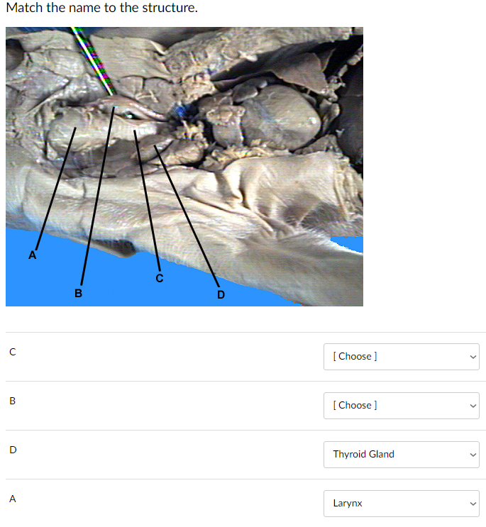 Solved The Diagram is of a fetal pig The answer choices are