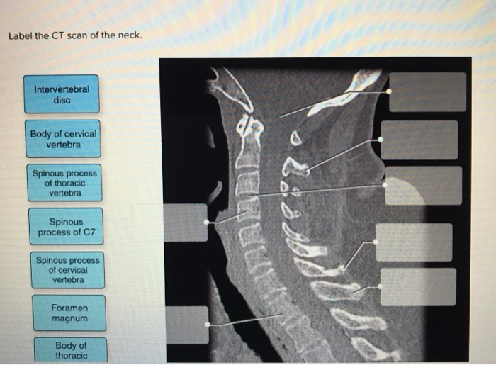 30 Label The Ct Scan Of The Neck Labels Design Ideas 2020