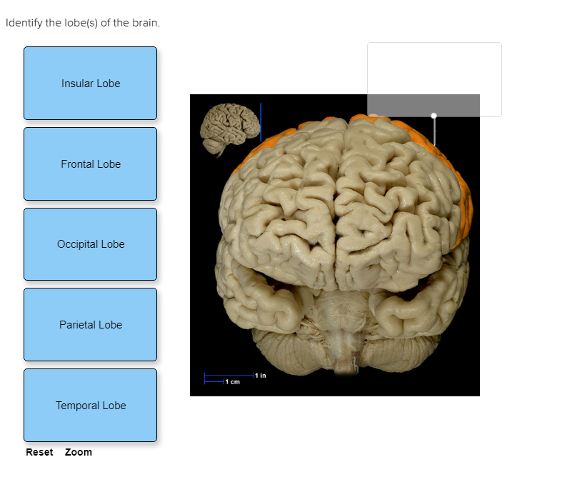 Insular Lobe