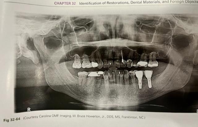 Solved Identify at least six different types of restorative 