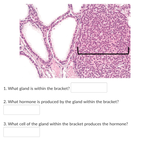 Solved 1. What gland is within the bracket? 2. What hormone | Chegg.com