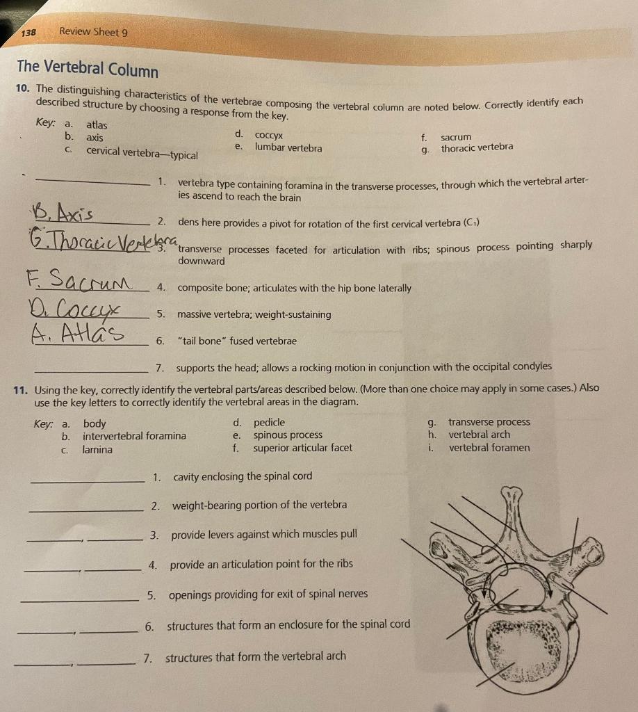 [Solved]: I need help identifying parts of the vertebral col