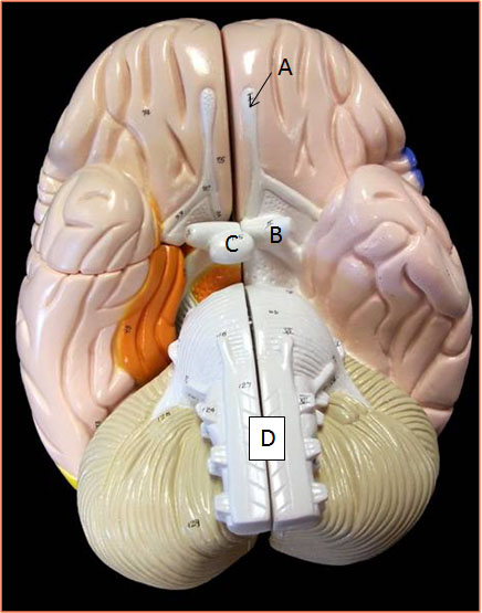 Solved Identify the pig muscles: A = Muscle name; B = | Chegg.com