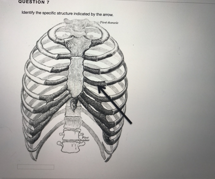 Solved Which of the following bones does NOT contain a | Chegg.com