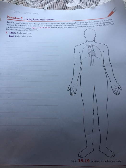 Solved Procedure 1 Tracing Blood Flow Patterns It is helpful