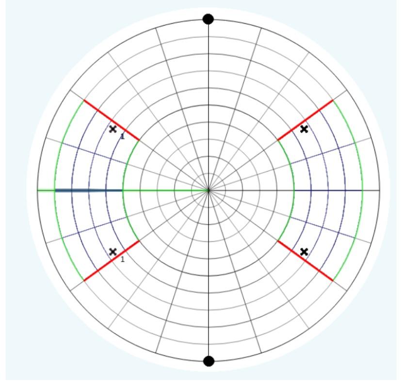 Solved 1) What is the type of digital filter shown? | Chegg.com