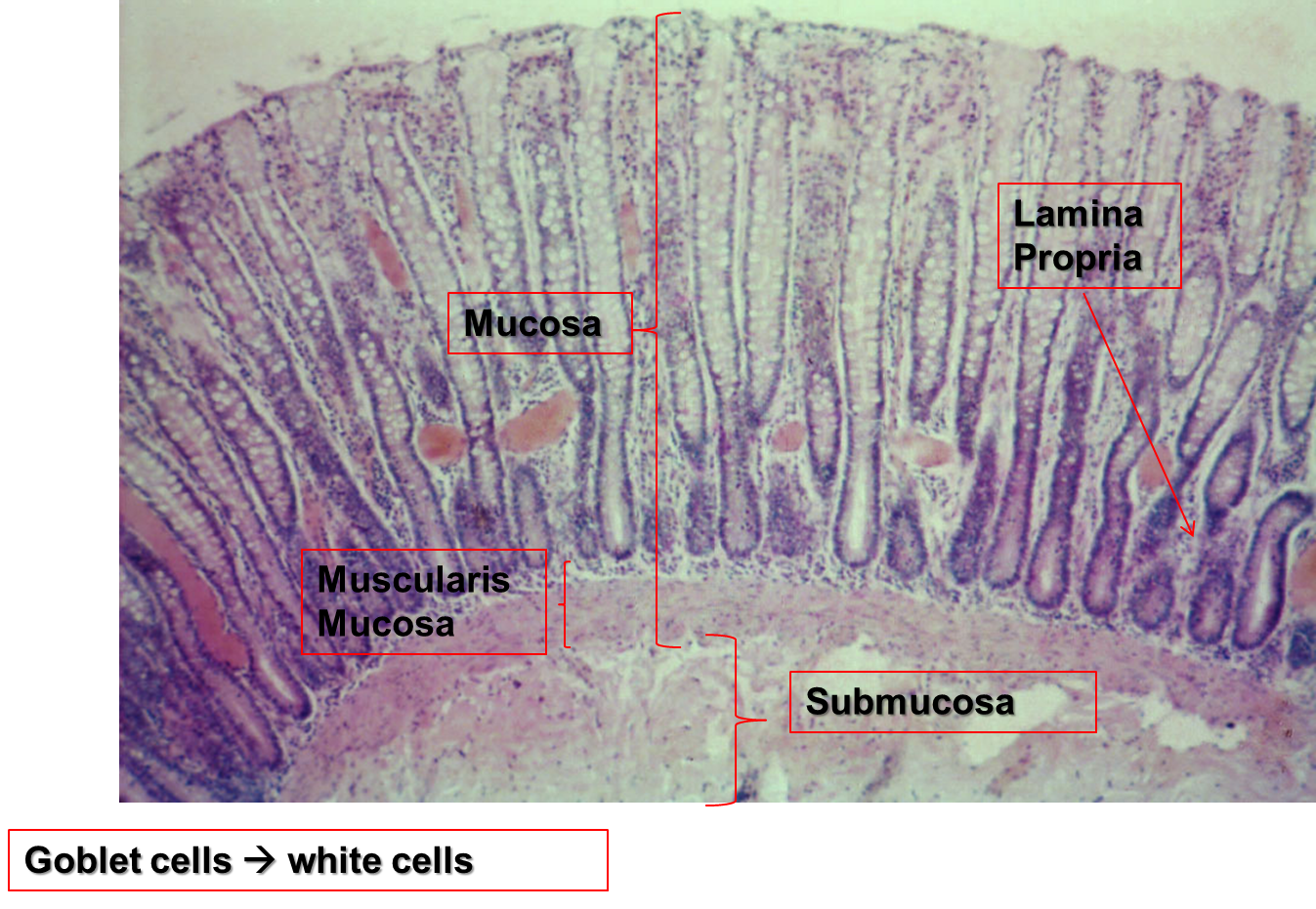 duodenum slide labeled