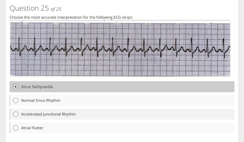 Sinus Tachycardia
Normal Sinus Rhythm
Accelerated Juncti