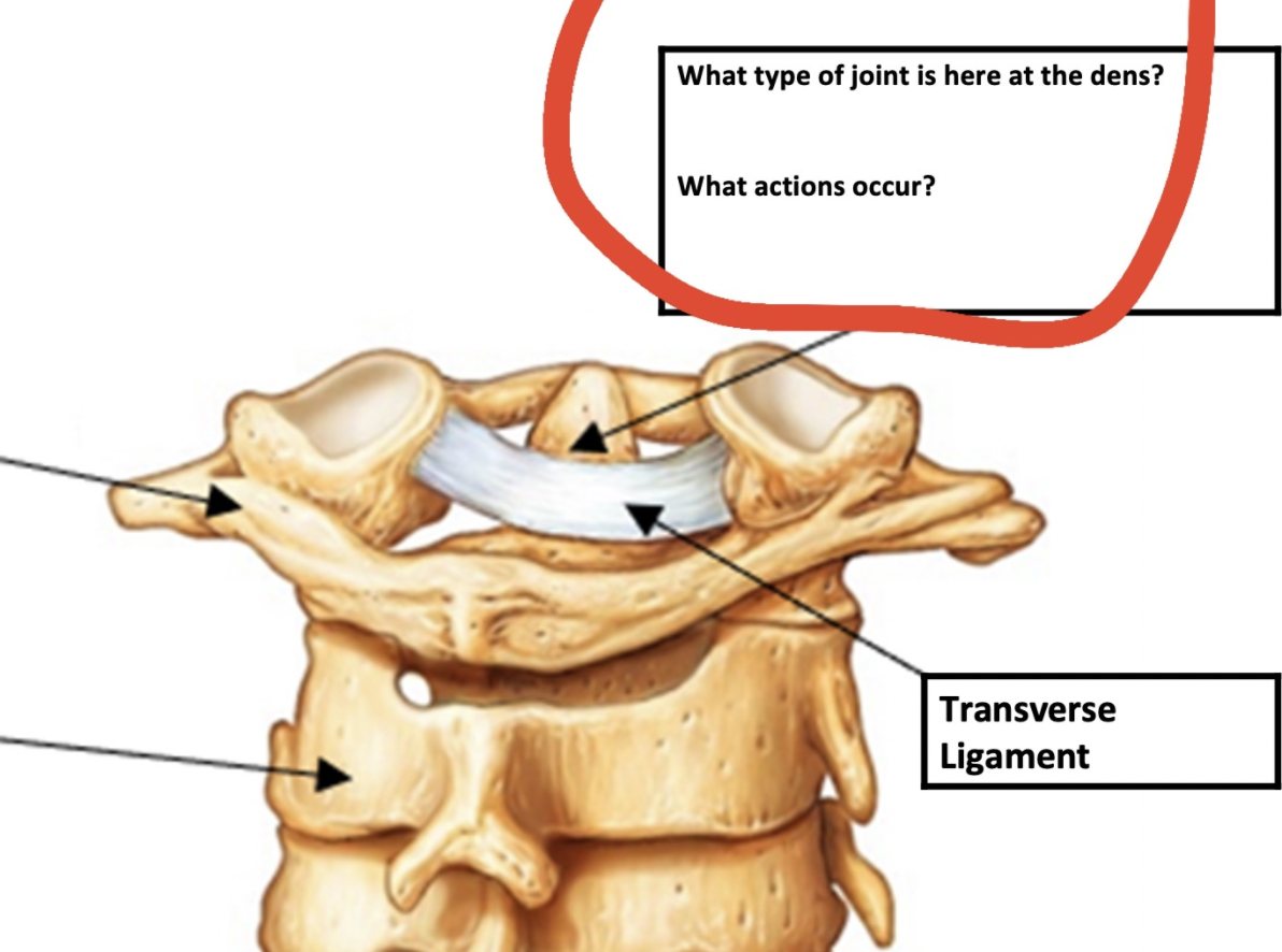 Solved What type of joint is here at the dens? What actions | Chegg.com