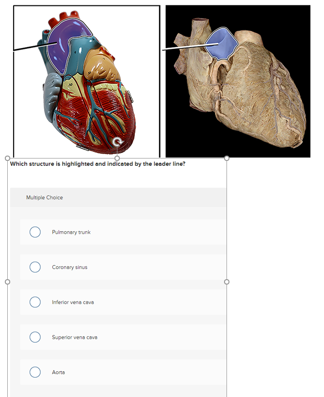 solved-which-structure-is-highlighted-and-indicated-by-the-chegg