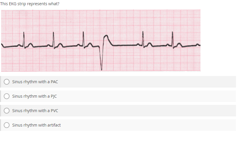 This EKG strip represents what?
Sinus rhythm with a PAC
Sinus rhythm with a PJC
Sinus rhythm with a PVC
Sinus rhythm with art