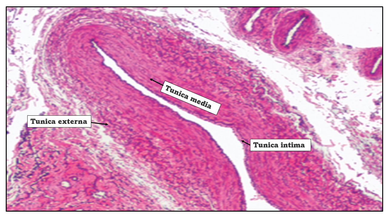 solved-tunica-externa-tunica-media-tunica-intima-chegg
