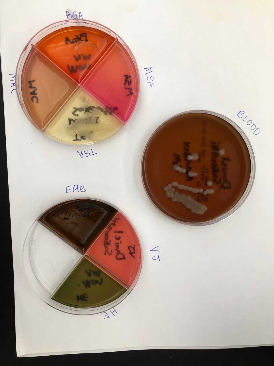 Solved Based On The Data Above Which Bacteria Is Present Chegg Com