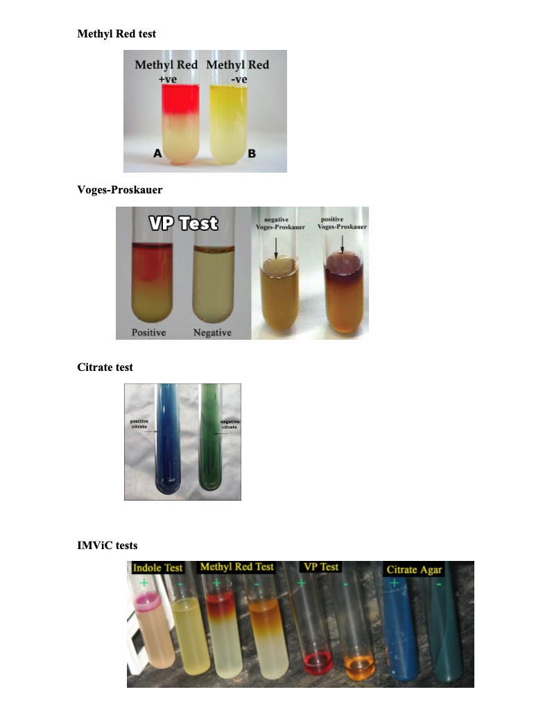 Solved Lab # 17: IMVIC The IMViC is a series of four tests | Chegg.com