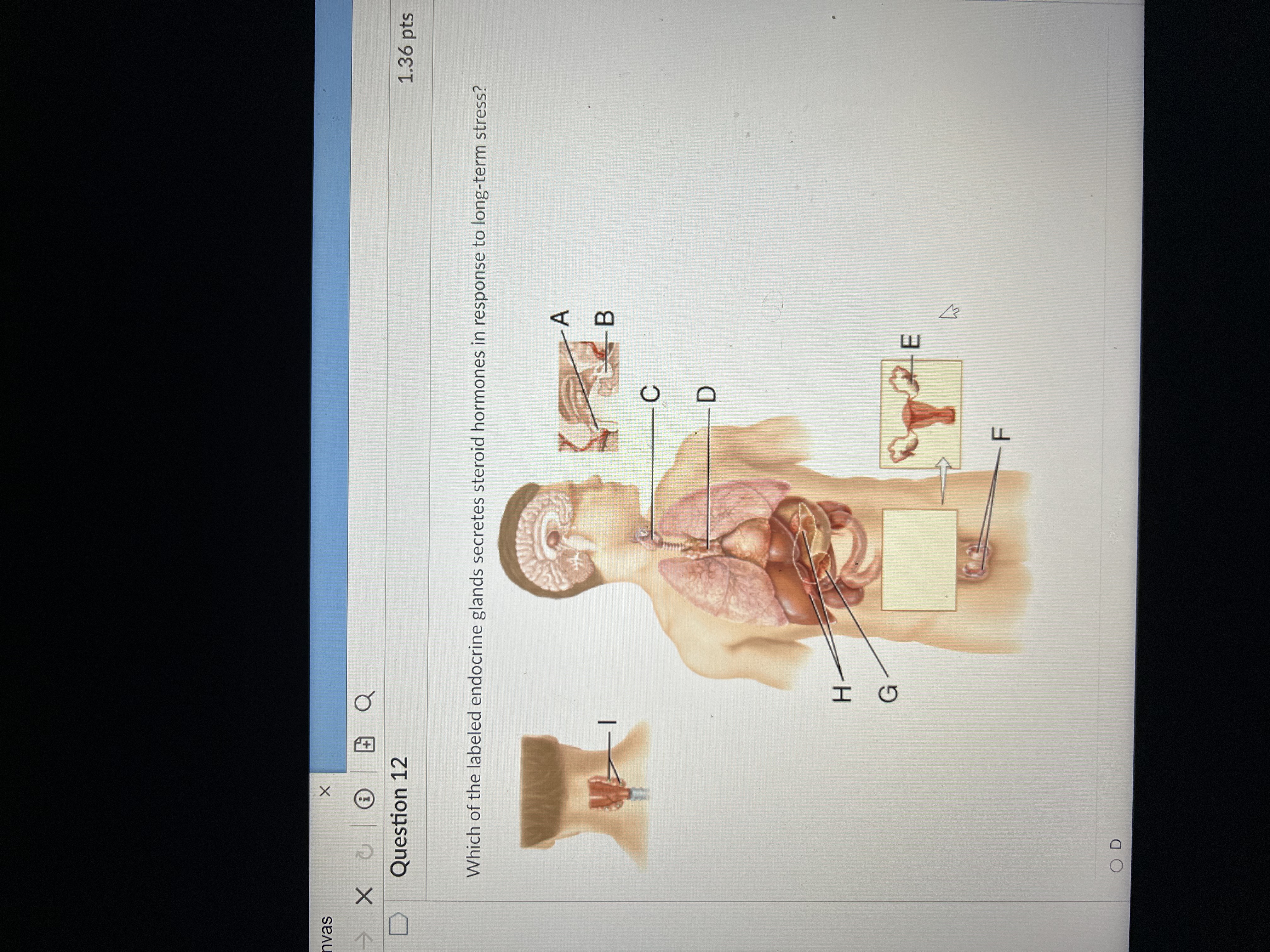 Solved Which of the labeled endocrine glands secretes | Chegg.com