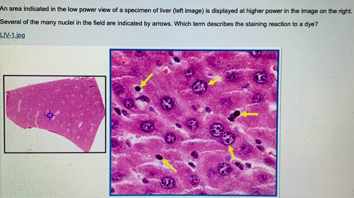 Solved An area indicated in the low power view of a specimen | Chegg.com