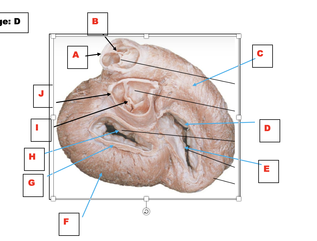 What is the section and view of the heart? Name | Chegg.com