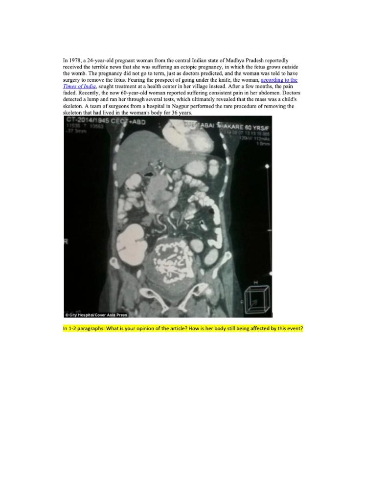 pelvic-mr-image-obtained-in-a-36-year-old-pregnant-woman-showing-a