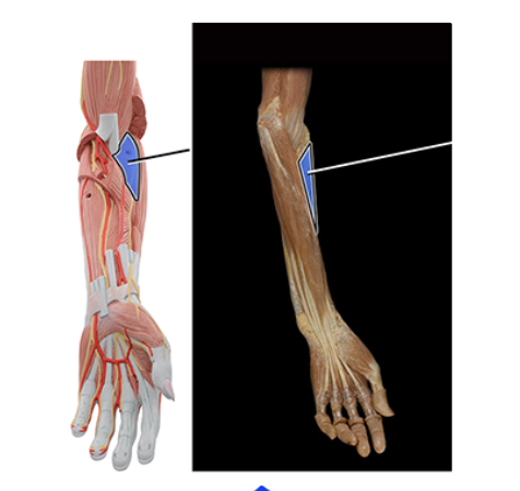 Solved O Flexor digitorum superficialis (cut on model) O | Chegg.com